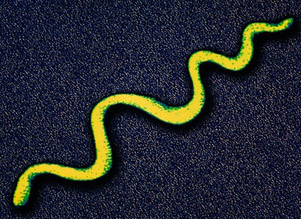 Image: Colored transmission electron micrograph (TEM) showing a Treponema pallidum bacterium, the cause of syphilis in humans (Photo courtesy of Alfred Pasieka / SPL).
